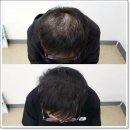 인천 두피관리 만족도가 높은 케어샵 토니에스엠피스튜디오 후기