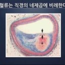 당신의 혈관이 깨끗해야 하는 이유 이미지