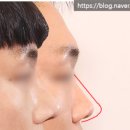 리터닝성형외과의원 이미지