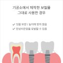 덴티움기공소 이미지