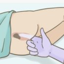 태항외과 네이버블로그