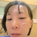 진 메디칼 | 30대 민감 피부 구원템 미엘메디칼 장벽크림으로 피부톤 트러블 올킬 후기 병풀크림의 기적