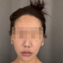 송파 에스테틱 잠실 에스테틱 루미나에스테틱 물방울 리프팅 맛집 솔직 후기