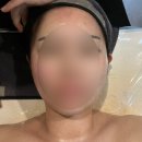 민위멍 | [성북구/정릉] 민스킨앤바디 :: 경락 솔직 후기, 통증, 가격, 안면윤곽 관리 전후 비교, 효과, 얼굴...