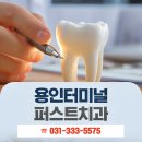 용인치과 전체임플란트 언제 해야 할까