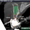 범플란트치과의원