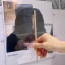 대우월드마크센텀 102동 앞 | 부산 해운대 두피관리 웰킨두피탈모센터 만족한 후기