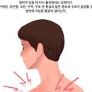 대상포진 신경통, 대상포진 후 후유증 남는 통증 정리 이미지