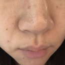 이정옥코스매턱화장품 | 마곡역피부관리 추천 프롬미마곡, 시그니처 맞춤케어 모공 미백 관리 솔직후기