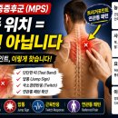 근막통증증후군(MPS) 왜 자꾸 원인을 놓칠까? 이미지