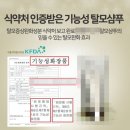 우울해 보이는 남편의 정수리탈모, 40대 아내가 발벗고 해결한 후기