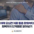 오십견의 원인과 비수술적 치료 | 어깨 오십견 치료, 통증 완화부터 회복까지 단계별로!