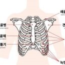 흉골 통증 원인 늑연골염 증상 치료 이미지