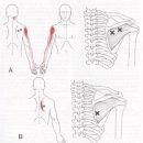 극하근 (Infraspinatus muscle) 이미지