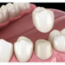 순치과기공소 이미지