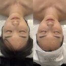 창원웨딩관리, 이중턱 싹 잡아주는 3v 윤곽관리맛집 어반브릭스피부샵 [매끄네 에스테틱]