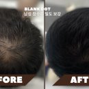 블랭크smp 이미지