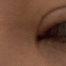 아이컨텍성형외과의원 이미지