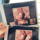 11500-22-25-23 | 임신 21주, 22주, 23주, 24주, 25주 후기(오키나와 태교여행)