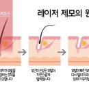 아띠의원 이미지