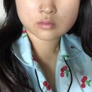 이지치과의원 | 울산 섬세한사랑니치과의원 사랑니 발치 후기(+이틀차~실밥풀기까지 후기)