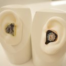 참소리보청기 이미지