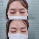 어려진의원 | [신사역] 강남 자연눈썹 잘하는 곳 추천! ‘리앤시뷰티’ 수지기법