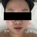 라인뷰티 | 봉담마사지 · 화성피부관리 라인뷰티어겐 후기