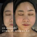 에코르아파트 앞 | 전주 웨딩관리 추천 르아떼에스테틱 작은얼굴 관리 후기