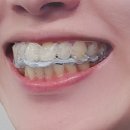 디메디코리아 이미지