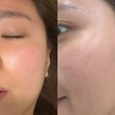 당당헤드 | [ 교대역 모공 홍조 관리 ] 바오뜨 에스테틱 시그니처 케어 + 헤드스칼프 솔직 후기