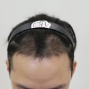 압구정맘모스헤어라인의원 이미지