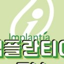 임플란티아