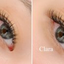 뷰티라인 이미지