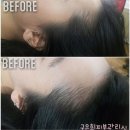 토탈헤어라인 - 평택시 | 토탈헤어라인