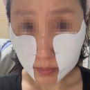 여우리 | [윤곽 리프팅] 여우리 붓기패치 사용 솔직 후기 | 홈케어 추천