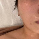오렌지PC방 | 울산 | 삼산 신부관리 피부관리 '라벨르 에스테틱' 레비덤 관리 솔직 후기
