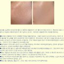 블라블라 - 산불피해 기부 함께해요! / 토르홉 후기모음 / VSL#3 면역유산균 미리보기