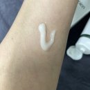 주성건강약국 | 손바닥 간지러움 원인별 해결법