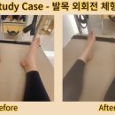 비기닝캐치 이미지