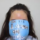 모힐의원 | 후기 사진 볼 때 반드시 확인할 사항!!!