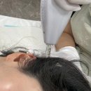 눈부신 그녀 | 대구 산후탈모 달서구 월성동 눈부신그녀 관리 후기 · 심각함 주의