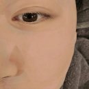 필내과의원 | [주간관리] 일주일동안 받은 피부 관리 정리해봄! 내돈내산 (짜증 가득 솔직 후기 주의...)