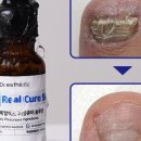 대박솔루션 이미지