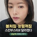 야호휴게점 | 강남역 리투오 스킨부스터 후기｜티 안 나게 달라진 피부