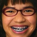미소채움치과의원 네이버블로그