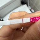 아이한의원 | 대추밭백한의원 한약 복용 후기 (매직아이 두줄)