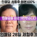 티뷰티아카데미 | 인셀덤크림 추천드려요~~