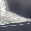 알즈너 점프 대리점 이미지