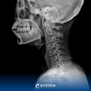 참사랑한의원 | 마산교통사고병원 괜찮다고 넘겼다가 결국 후회합니다 [참사랑한의원 대표원장 직접 작성]